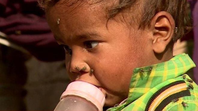 India has one of the highest numbers of deaths from diarrhoea