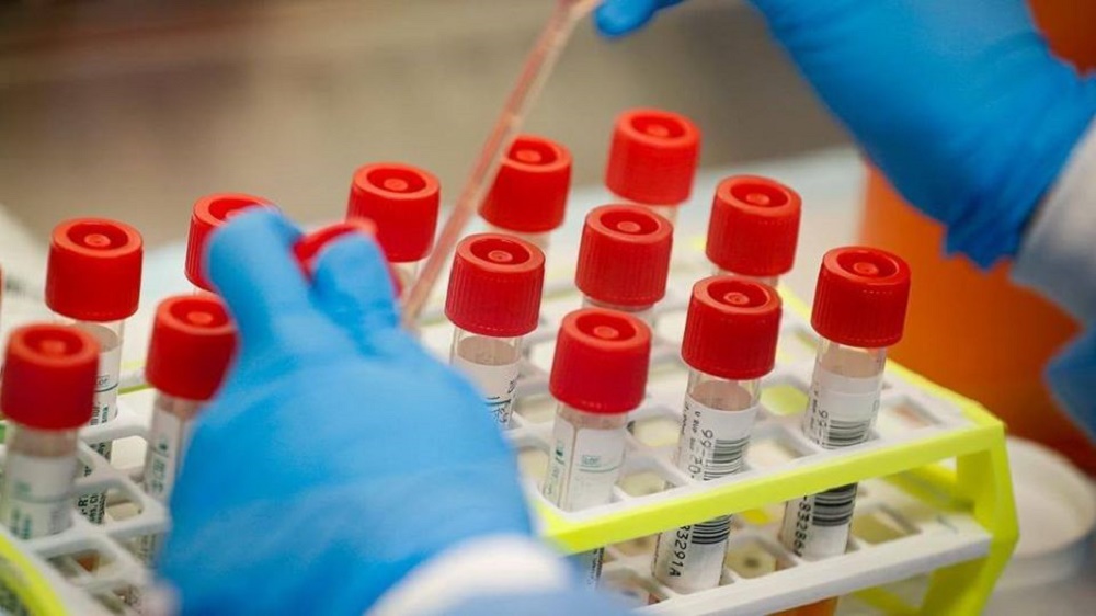 Dr. José Nyamusore,  RBC Head of Epidemic Surveillance and Response, said the seven cases who were confirmed to be infected are responding well to treatment.