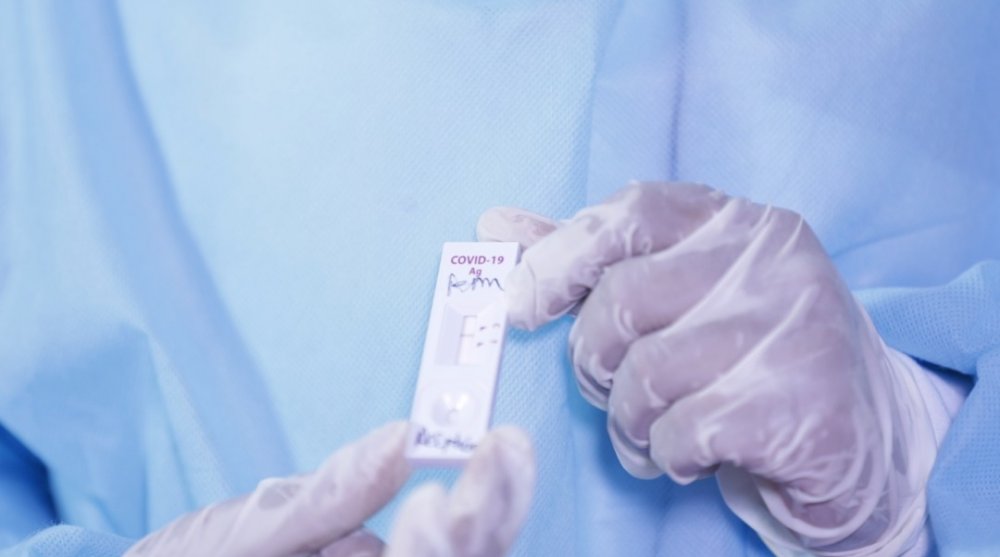 The rapid antigen test lasts between ten and 15 minutes.
