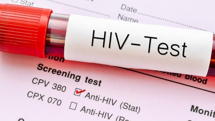 Prime Minister, Edouard Ngirente has said that Rwanda is making good progress in controlling the HIV epidemic.