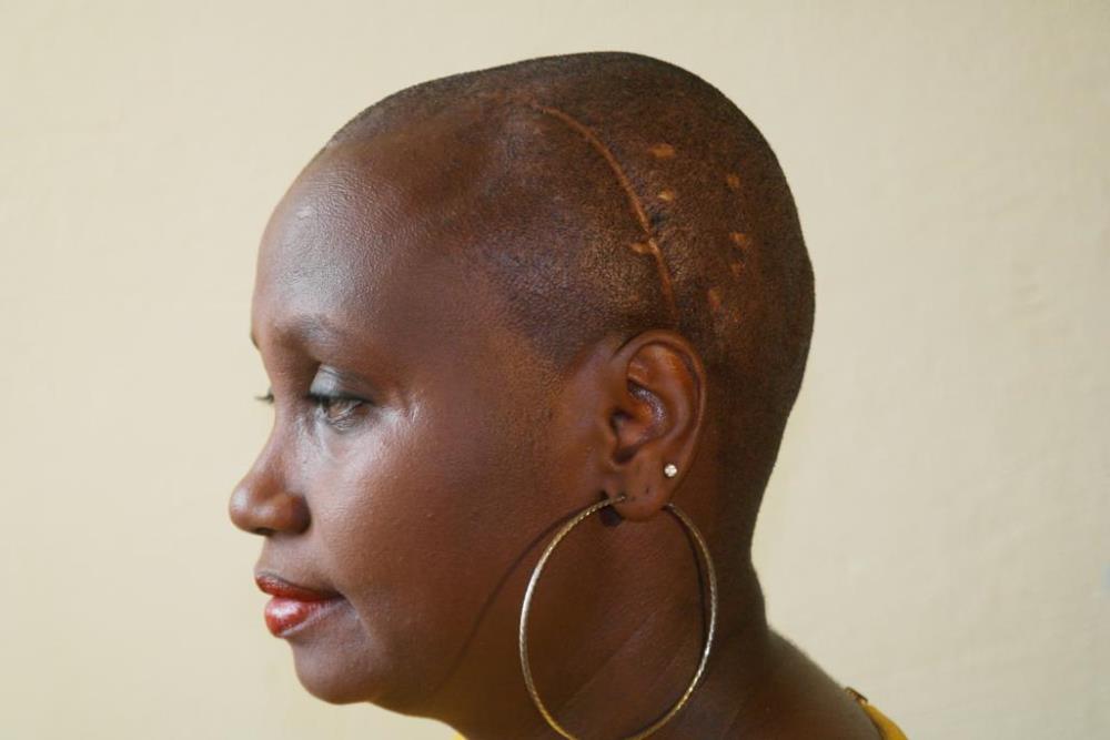 Though she survived, Kayitesi was cut on the head and was left with a gushing wound.