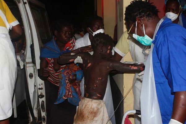 A badly injured person arrives at Tete hospital following the explosion that left at least 73 people dead.