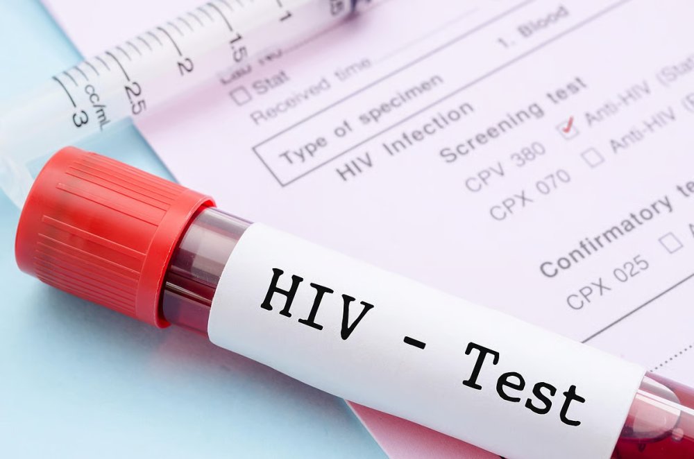 Data from the National Institute of Statistics of Rwanda (NISR) reveal that, between 2019 and 2024, a total of 54,287 people in Rwanda were diagnosed with HIV. The highest numbers were recorded in the City of Kigali and the Western Province.
