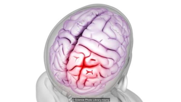Headaches can be unbearably intense