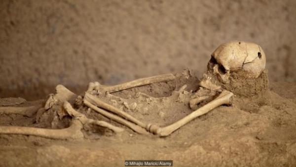 A trepanned skeleton