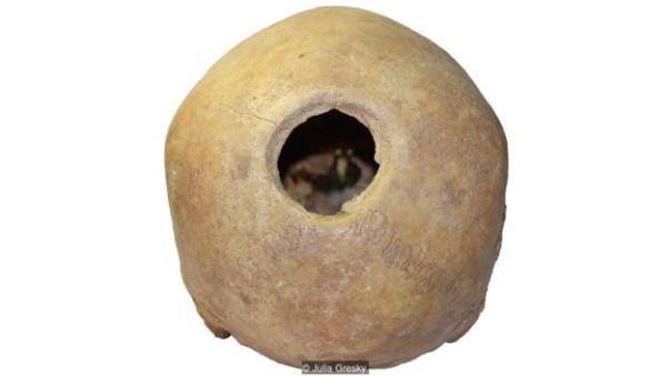 The trepanned skull of a 20-25-year-old female. The trepanation hole has only partially healed, suggesting she died within 8 weeks of the operation