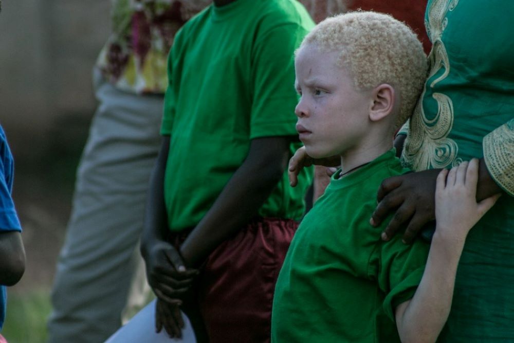Dusabejambo’s other notable works include "A Place for Myself," which highlights the challenges faced by people with albinism.