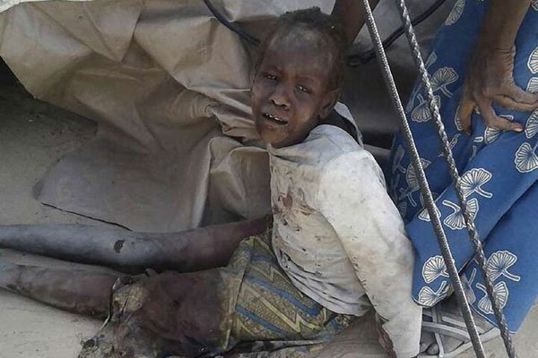 A wounded child after an air force jet accidentally bombarded a camp for those displaced by Boko Haram Islamists, in Rann, northeast Nigeria.