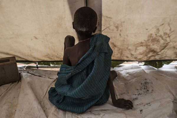 A boy suffering from cholera and severe malnutrition sits on the floor of a tent converted into a temporary field hospital near the remote village of Dor, South Sudan on April 28, 2017. About 400 British soldiers will join the UN peacekeeping force in South Sudan.