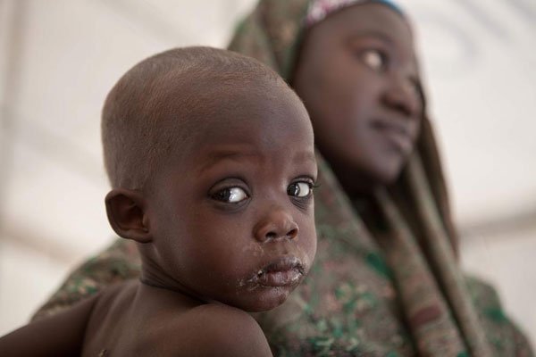 Many women and children are suffering from lack of food, clean water and medical care in northeast Nigeria.