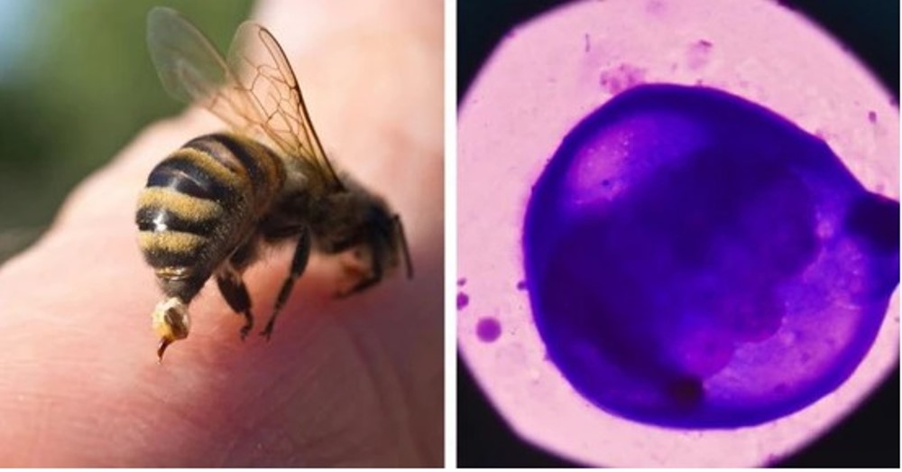 A compound in the venom called melittin could destroy breast cancer cells within an hour.  (CREDIT: Creative Commons)