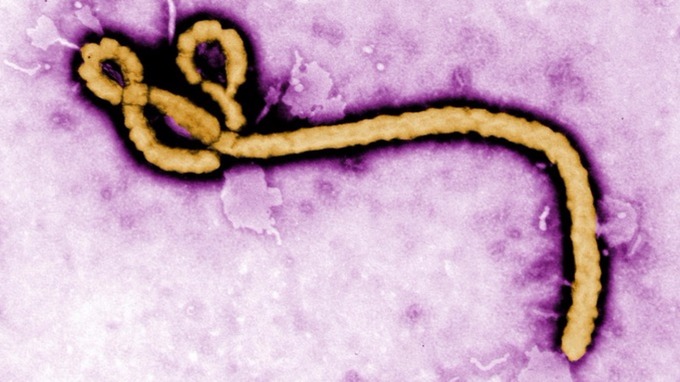 An Ebola virus virion is seen in this electron micrograph image