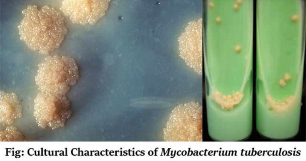 Rwandan Researchers Discover New Tuberculosis Bacteria