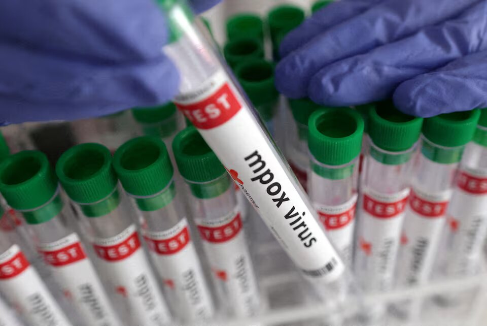 France's health ministry said the patient, a woman from the Brittany region, had not travelled to Central Africa but had contact with two individuals who had recently returned from the area.